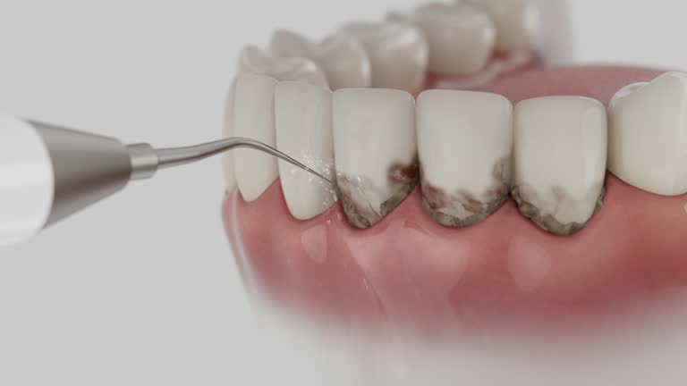 Reliable Dental contractor in Bellville, OH by Dentist Open Now
